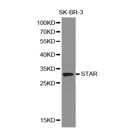 Western blot - STAR Antibody from Signalway Antibody (32129) - Antibodies.com