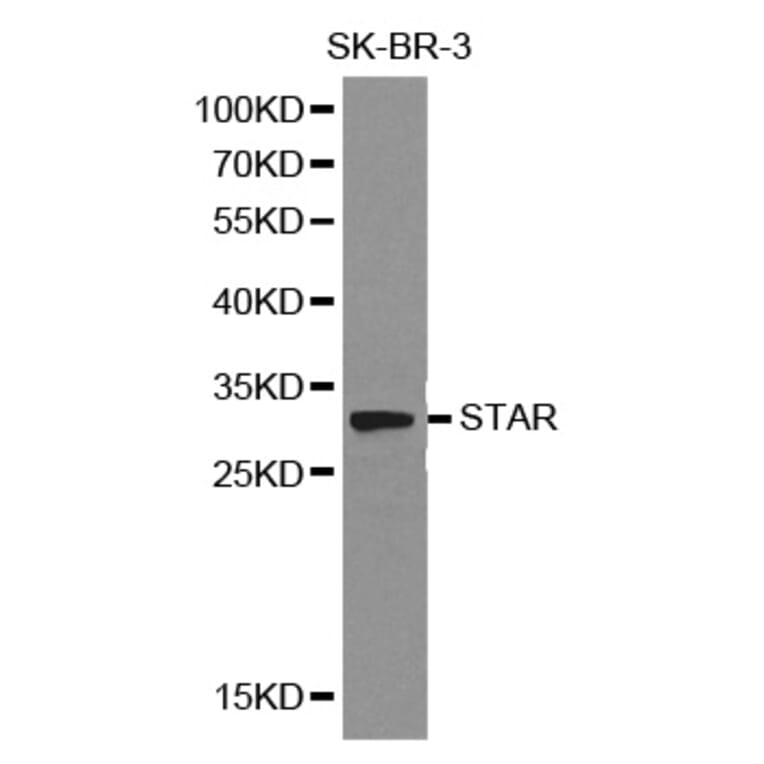 Western blot - STAR Antibody from Signalway Antibody (32129) - Antibodies.com
