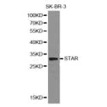 Western blot - STAR Antibody from Signalway Antibody (32129) - Antibodies.com