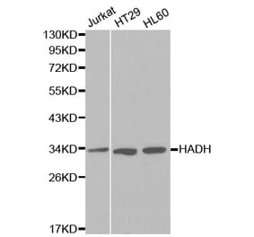 Western blot - HADH Antibody from Signalway Antibody (32148) - Antibodies.com