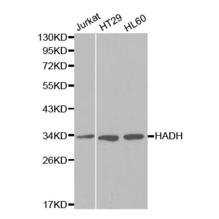 Western blot - HADH Antibody from Signalway Antibody (32148) - Antibodies.com