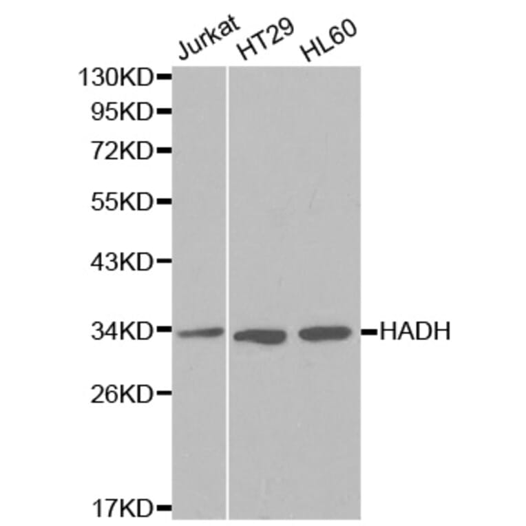 Western blot - HADH Antibody from Signalway Antibody (32148) - Antibodies.com