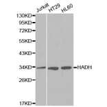 Western blot - HADH Antibody from Signalway Antibody (32148) - Antibodies.com