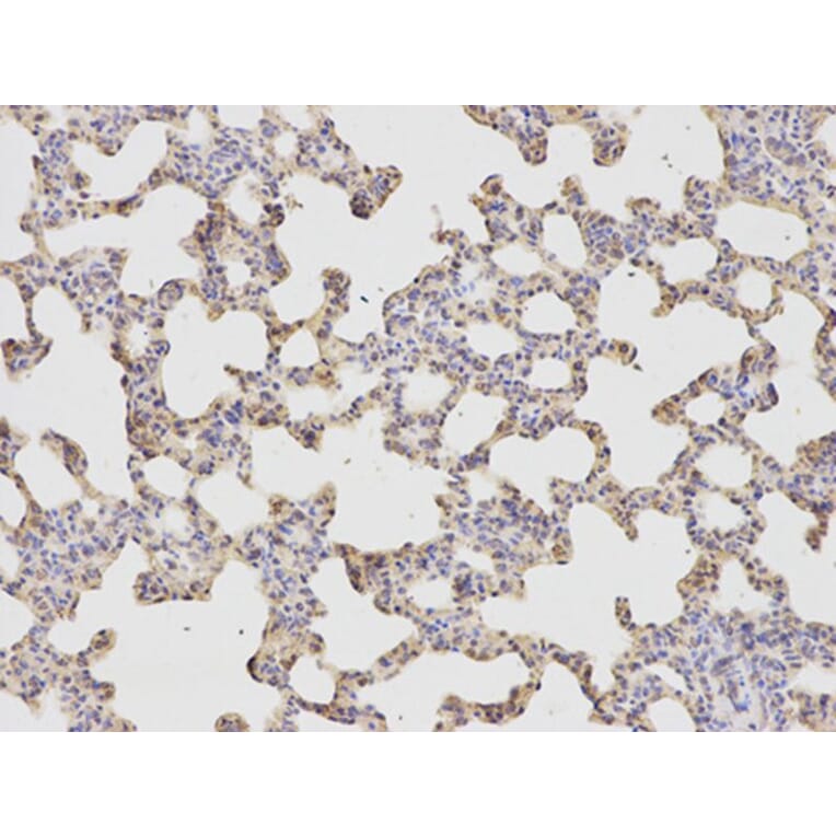 Immunohistochemistry - HADH Antibody from Signalway Antibody (32148) - Antibodies.com