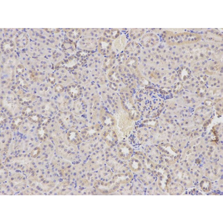 Immunohistochemistry - HADH Antibody from Signalway Antibody (32148) - Antibodies.com