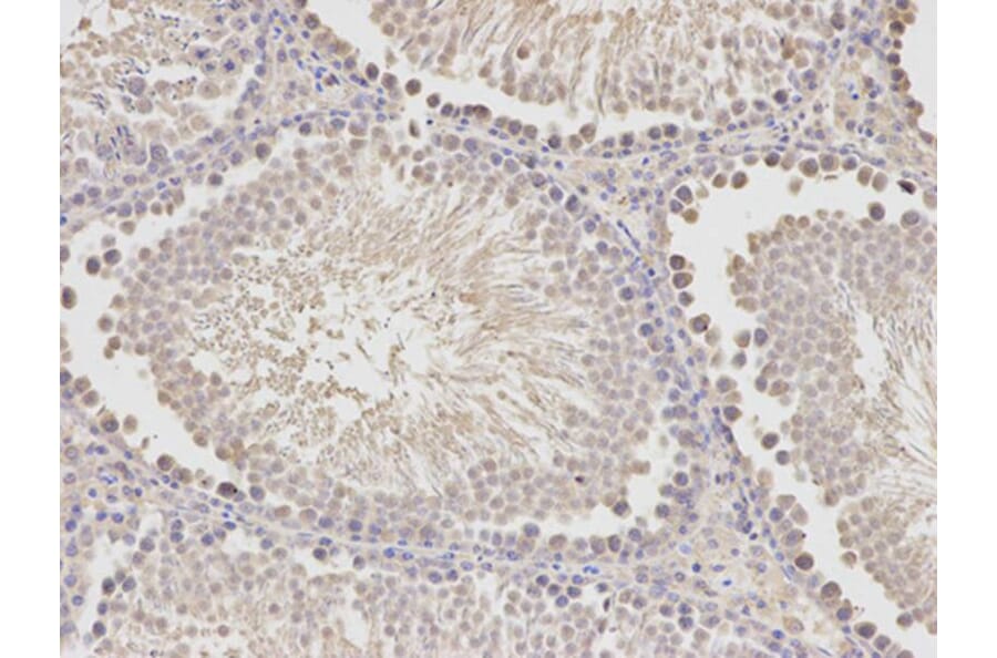 Immunohistochemistry - HADH Antibody from Signalway Antibody (32148) - Antibodies.com