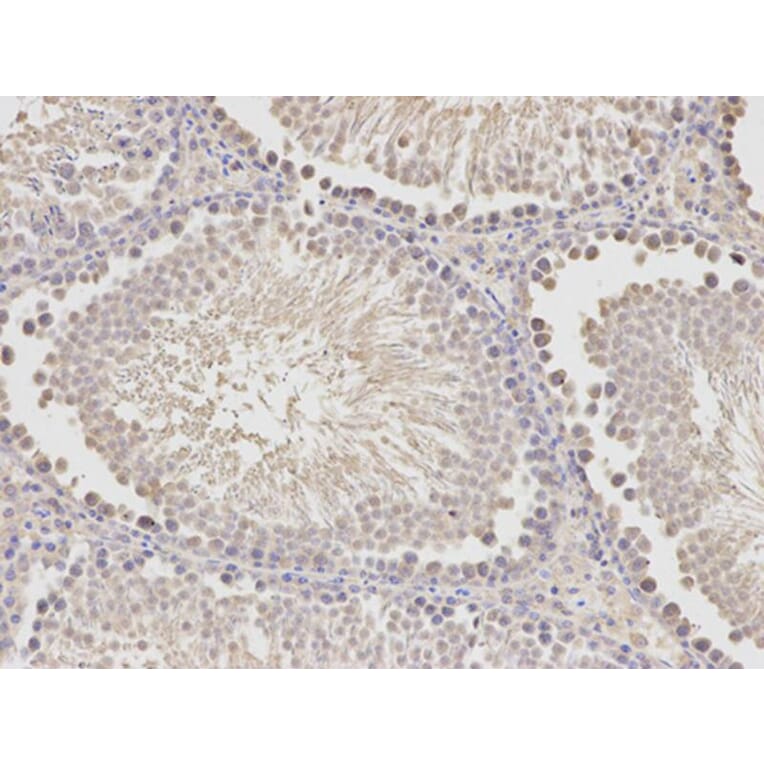 Immunohistochemistry - HADH Antibody from Signalway Antibody (32148) - Antibodies.com