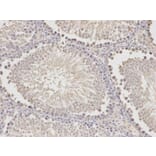 Immunohistochemistry - HADH Antibody from Signalway Antibody (32148) - Antibodies.com