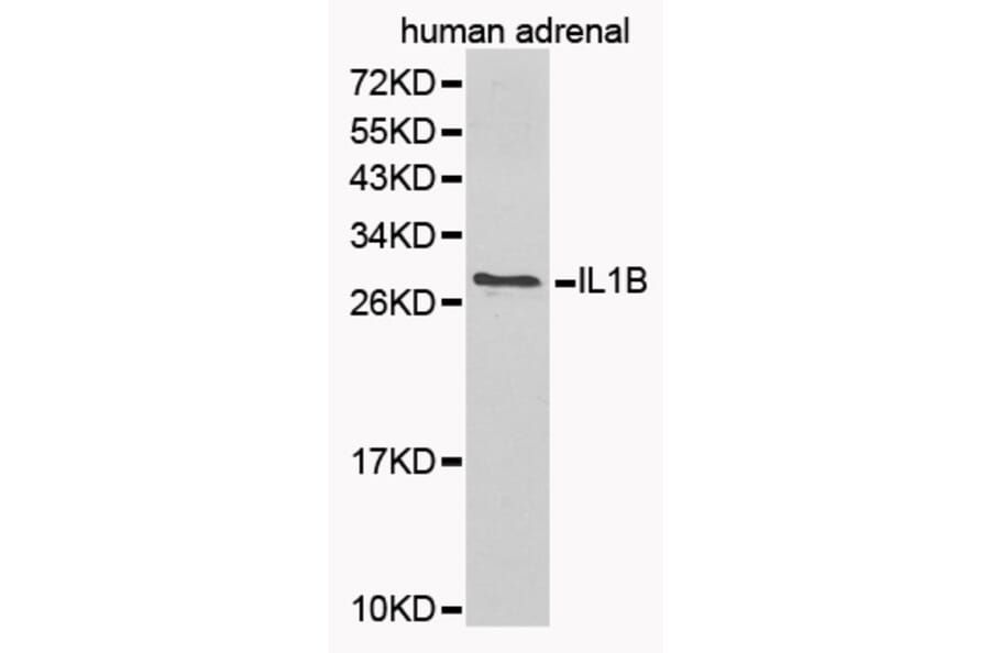Western blot - IL1B Antibody from Signalway Antibody (32165) - Antibodies.com