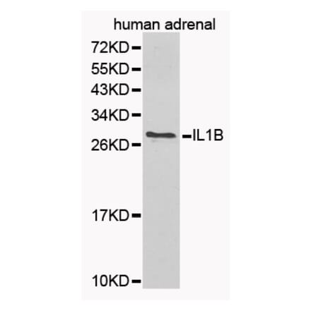 Western blot - IL1B Antibody from Signalway Antibody (32165) - Antibodies.com