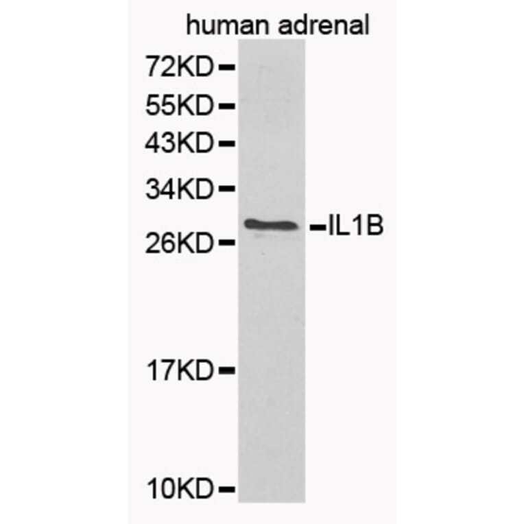 Western blot - IL1B Antibody from Signalway Antibody (32165) - Antibodies.com