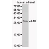 Western blot - IL1B Antibody from Signalway Antibody (32165) - Antibodies.com
