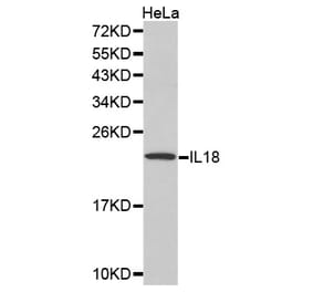 Western blot - IL18 Antibody from Signalway Antibody (32166) - Antibodies.com
