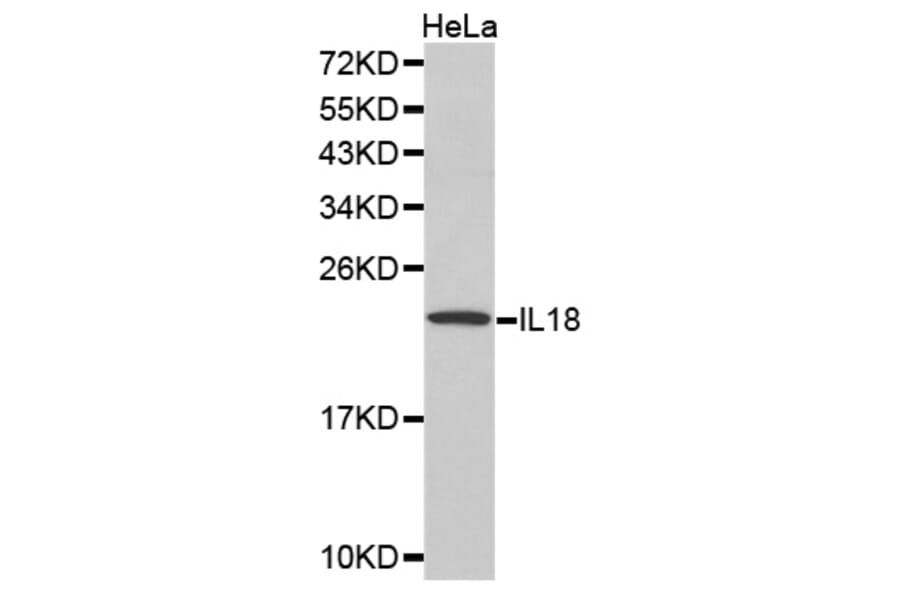 Western blot - IL18 Antibody from Signalway Antibody (32166) - Antibodies.com