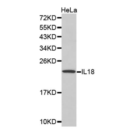 Western blot - IL18 Antibody from Signalway Antibody (32166) - Antibodies.com