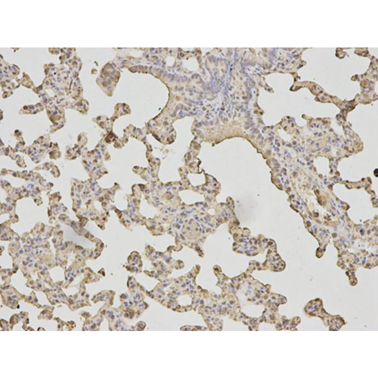 Immunohistochemistry - LDHA Antibody from Signalway Antibody (32182) - Antibodies.com