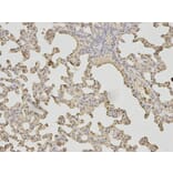 Immunohistochemistry - LDHA Antibody from Signalway Antibody (32182) - Antibodies.com