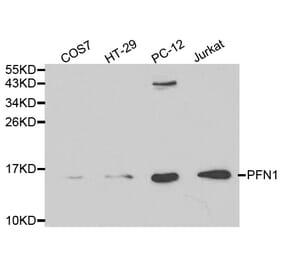 Western blot - PFN1 Antibody from Signalway Antibody (32195) - Antibodies.com