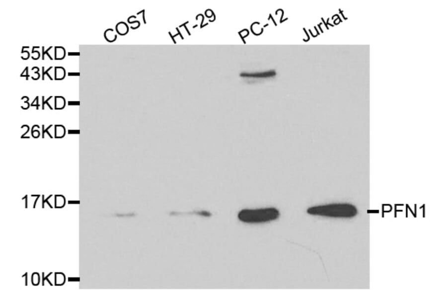 Western blot - PFN1 Antibody from Signalway Antibody (32195) - Antibodies.com
