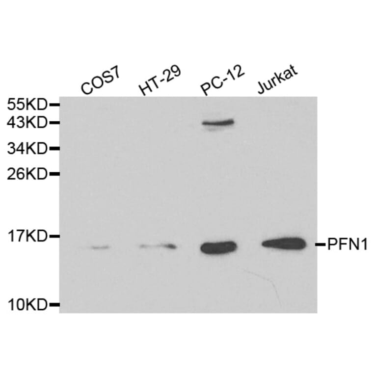 Western blot - PFN1 Antibody from Signalway Antibody (32195) - Antibodies.com
