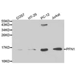 Western blot - PFN1 Antibody from Signalway Antibody (32195) - Antibodies.com