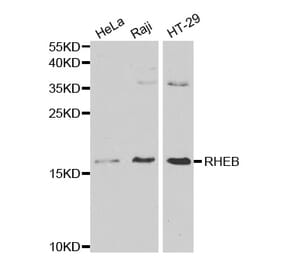 Western blot - RHEB Antibody from Signalway Antibody (32196) - Antibodies.com