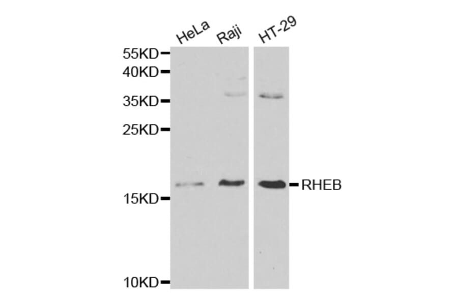Western blot - RHEB Antibody from Signalway Antibody (32196) - Antibodies.com