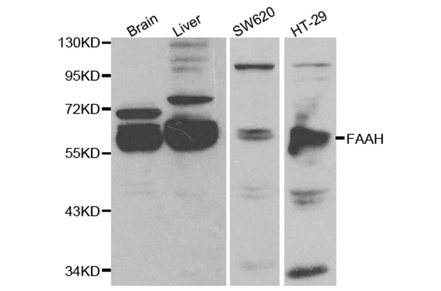 Western blot - FAAH Antibody from Signalway Antibody (32203) - Antibodies.com