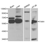 Western blot - FAAH Antibody from Signalway Antibody (32203) - Antibodies.com