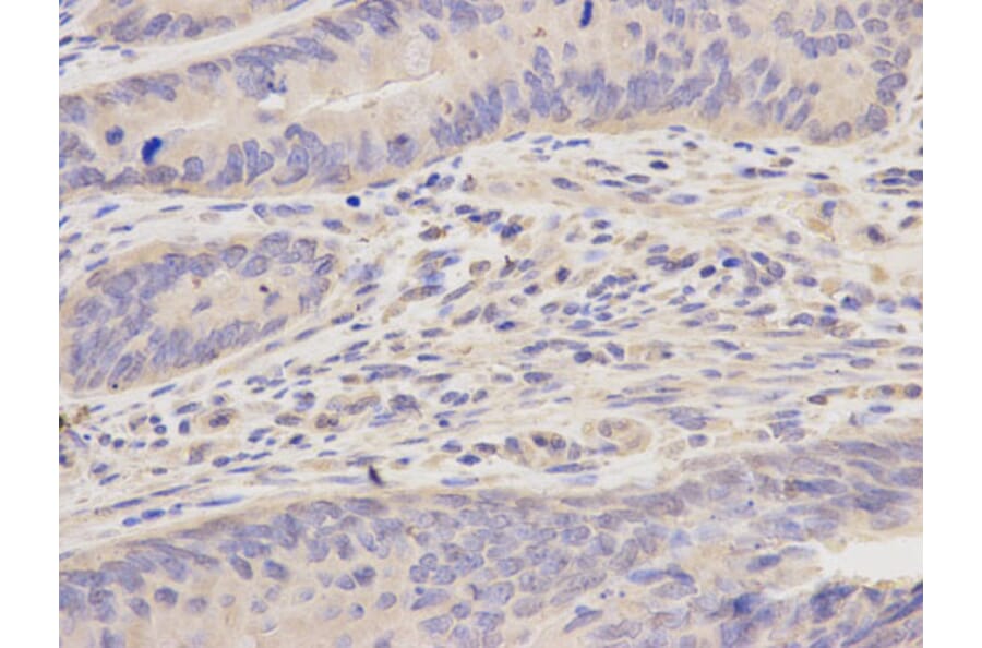 Immunohistochemistry - FEN1 Antibody from Signalway Antibody (32204) - Antibodies.com