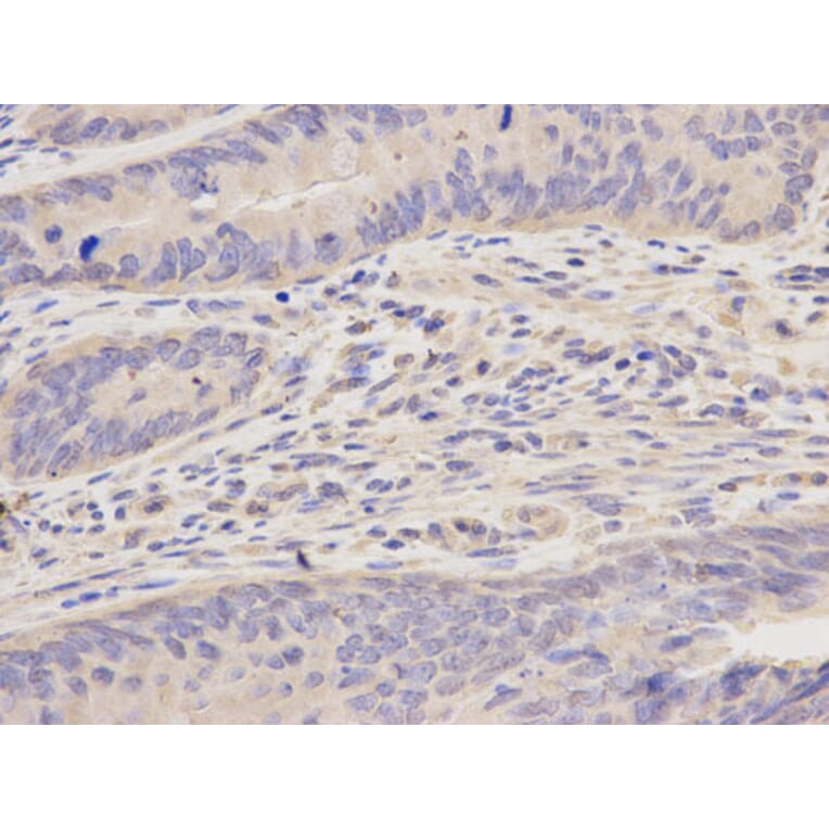 Immunohistochemistry - FEN1 Antibody from Signalway Antibody (32204) - Antibodies.com
