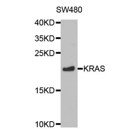 Western blot - KRAS Antibody from Signalway Antibody (32216) - Antibodies.com
