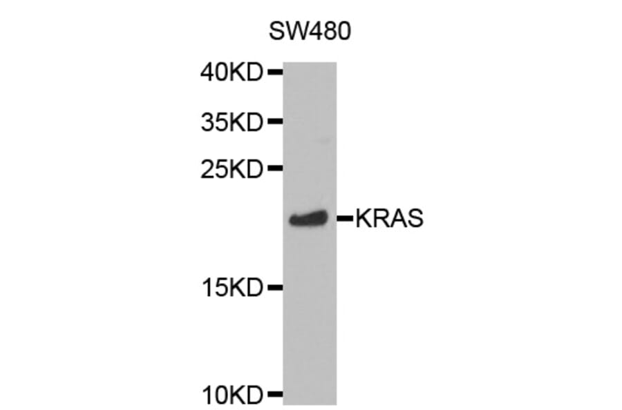 Western blot - KRAS Antibody from Signalway Antibody (32216) - Antibodies.com