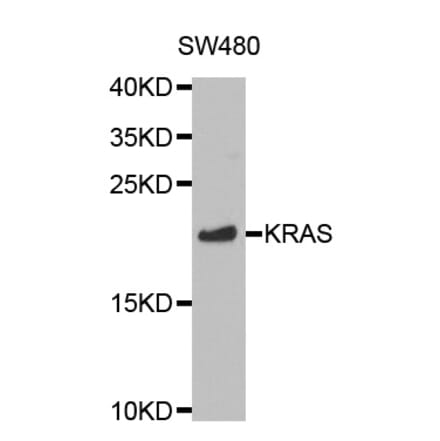 Western blot - KRAS Antibody from Signalway Antibody (32216) - Antibodies.com