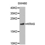 Western blot - KRAS Antibody from Signalway Antibody (32216) - Antibodies.com