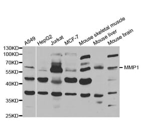 Western blot - MMP1 Antibody from Signalway Antibody (32217) - Antibodies.com