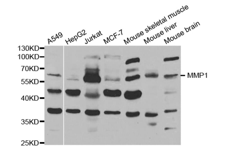 Western blot - MMP1 Antibody from Signalway Antibody (32217) - Antibodies.com