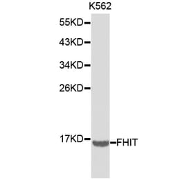 Western blot - FHIT Antibody from Signalway Antibody (32220) - Antibodies.com