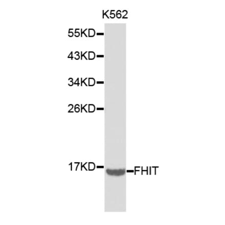 Western blot - FHIT Antibody from Signalway Antibody (32220) - Antibodies.com