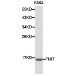 Western blot - FHIT Antibody from Signalway Antibody (32220) - Antibodies.com