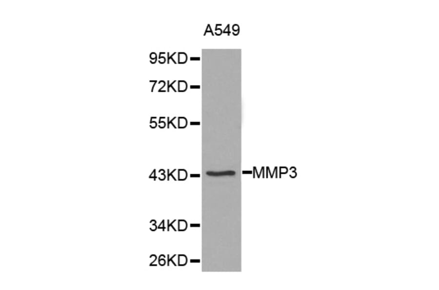 Western blot - MMP3 Antibody from Signalway Antibody (32225) - Antibodies.com