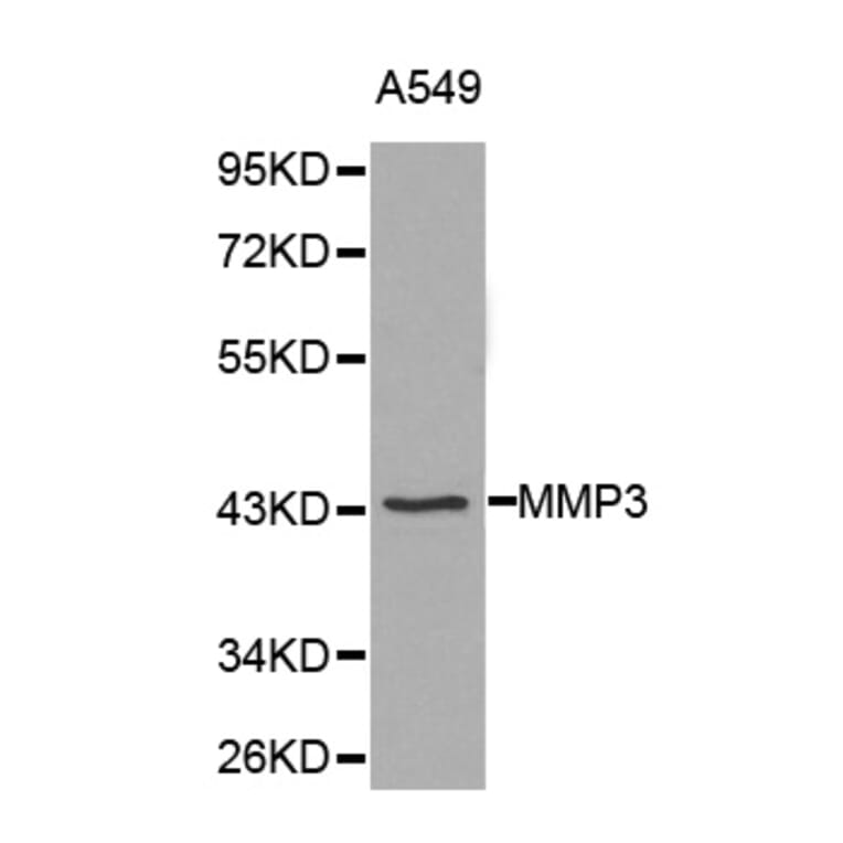 Western blot - MMP3 Antibody from Signalway Antibody (32225) - Antibodies.com