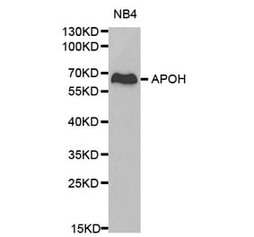Western blot - APOH Antibody from Signalway Antibody (32237) - Antibodies.com