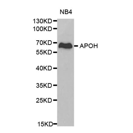 Western blot - APOH Antibody from Signalway Antibody (32237) - Antibodies.com