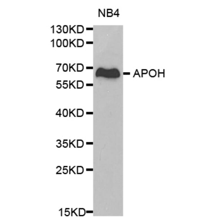 Western blot - APOH Antibody from Signalway Antibody (32237) - Antibodies.com