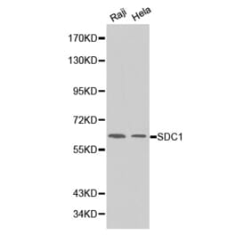 Western blot - SDC1 Antibody from Signalway Antibody (32248) - Antibodies.com