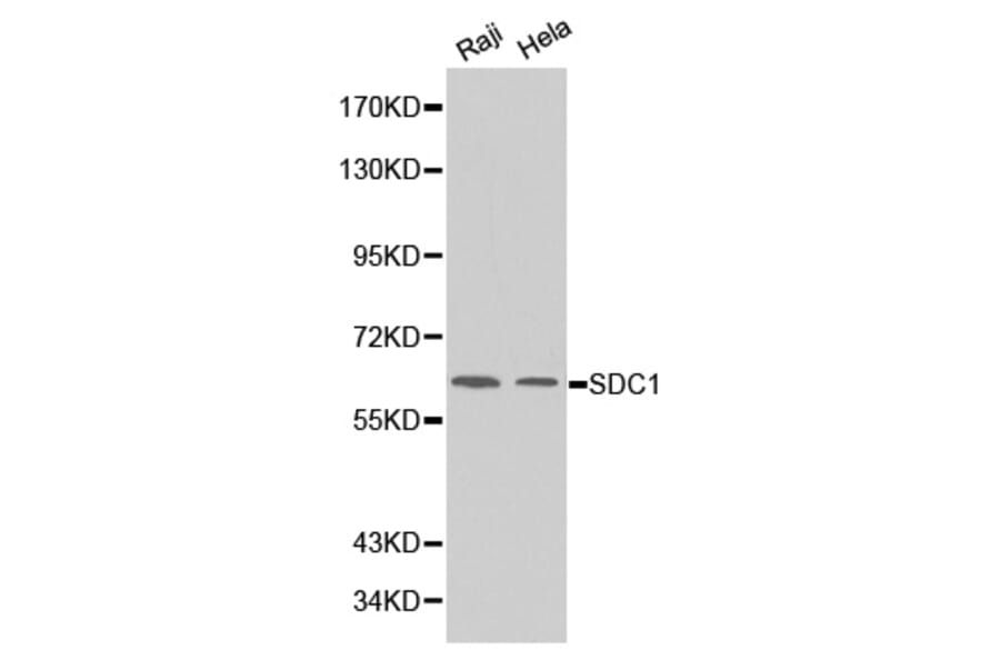 Western blot - SDC1 Antibody from Signalway Antibody (32248) - Antibodies.com