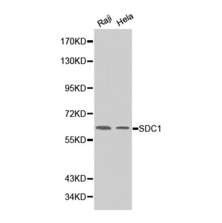 Western blot - SDC1 Antibody from Signalway Antibody (32248) - Antibodies.com
