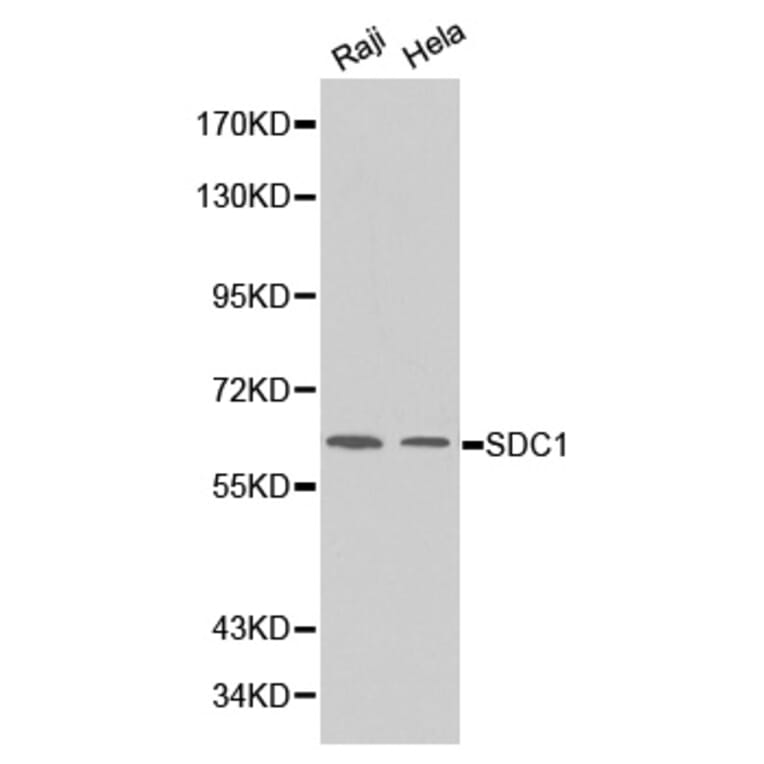 Western blot - SDC1 Antibody from Signalway Antibody (32248) - Antibodies.com
