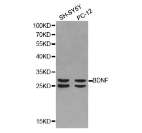 Western blot - BDNF Antibody from Signalway Antibody (32263) - Antibodies.com